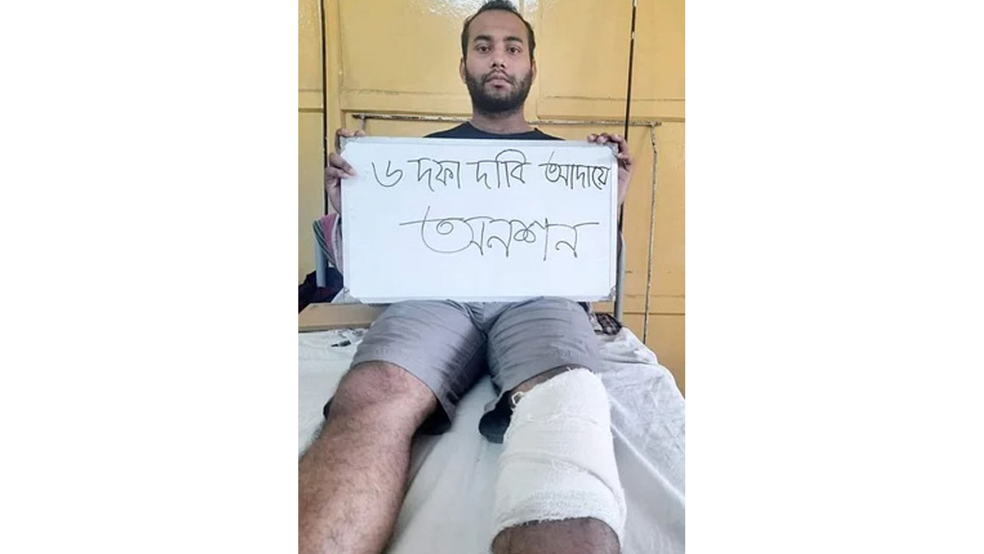 মেডিকেল সেন্টার আধুনিকায়নের দাবিতে তৃতীয় দিনের মতো অনশনে ঢাবি শিক্ষার্থী