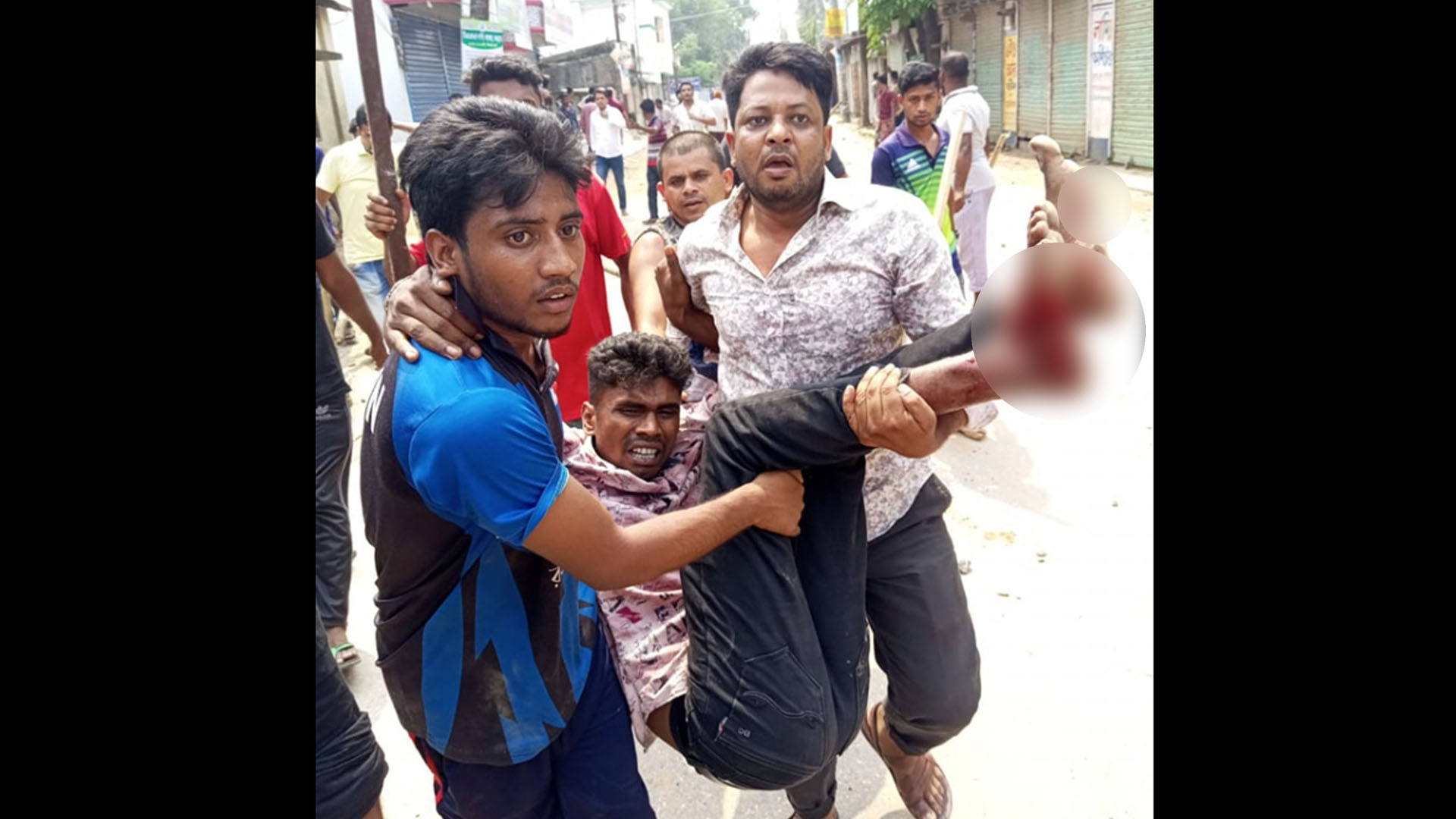 বগুড়ায় আ. লীগ-বিএনপি সংঘর্ষ, ৩ গুলিবিদ্ধসহ আহত ১৫