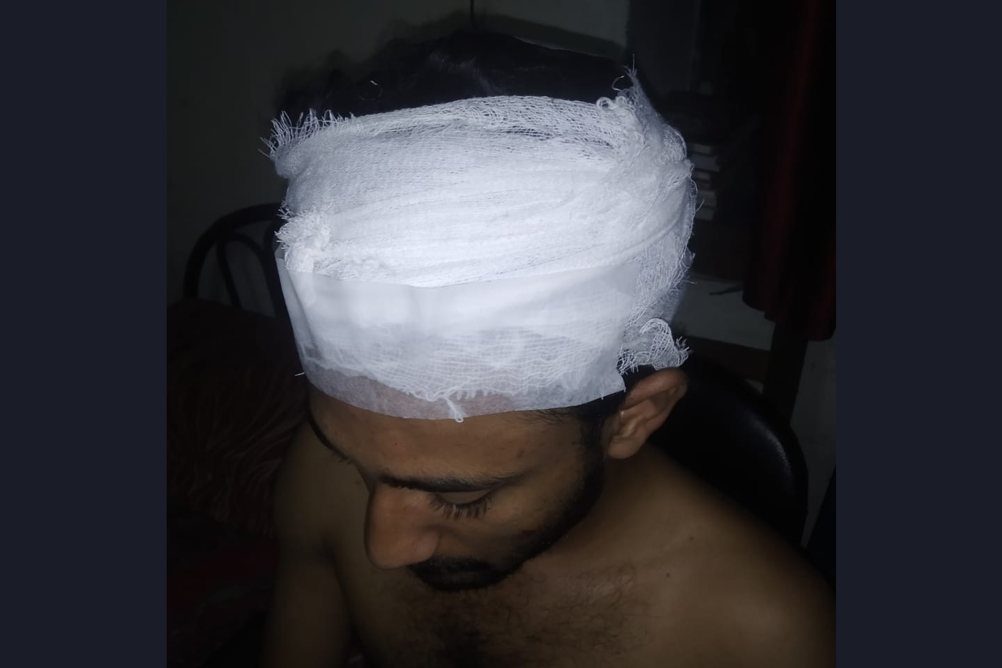 নিম্নমানের খাবারের বিরুদ্ধে প্রতিবাদ, নিজ সংগঠনের কর্মীকে পেটাল ছাত্রলীগ