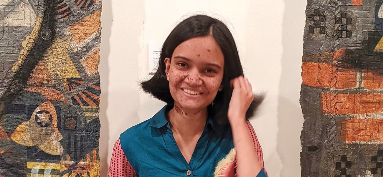 সারার কর্নিয়ায় চোখের আলো ফিরে পেলেন দুজন