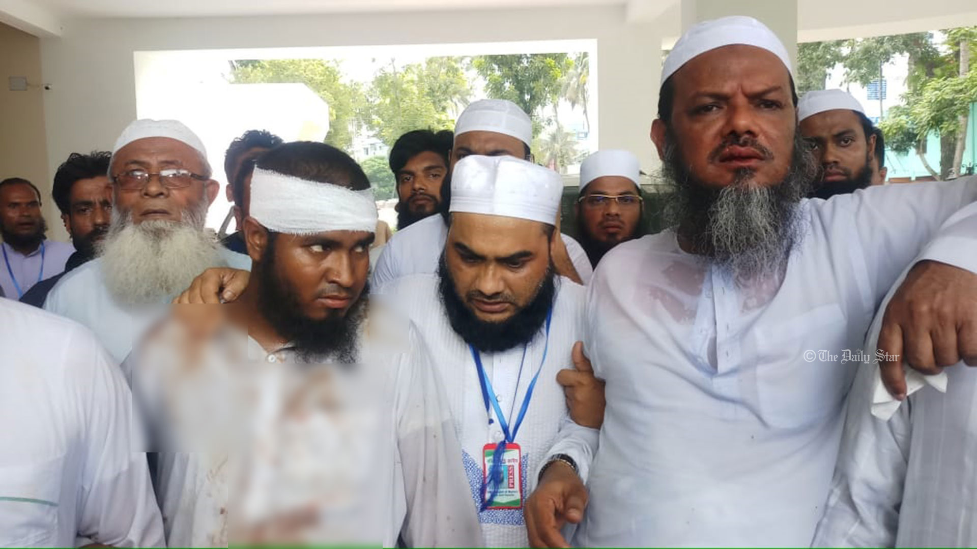 হাতপাখার মেয়রপ্রার্থী ফয়জুলের ওপর হামলা