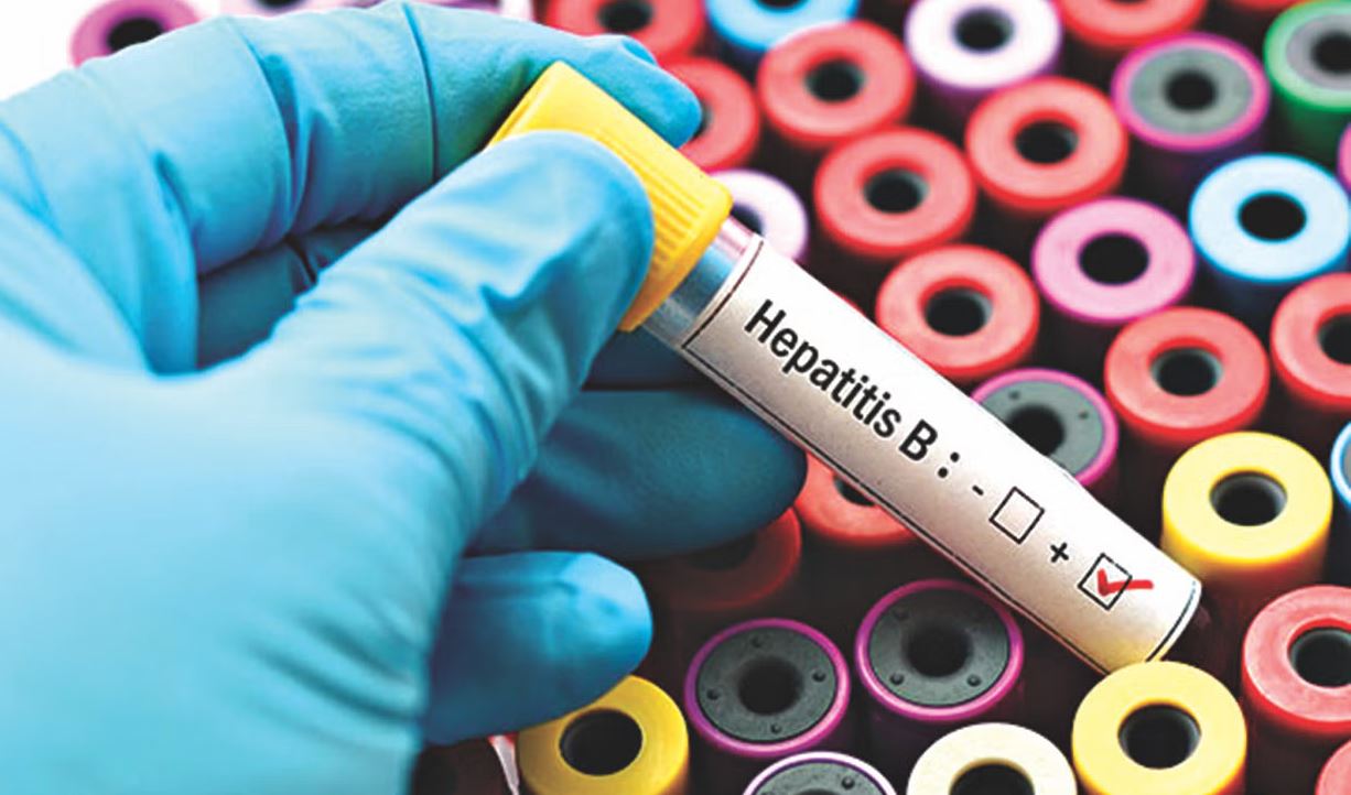 হেপাটাইটিস বি কীভাবে ছড়ায়, লক্ষণ ও চিকিৎসা কী