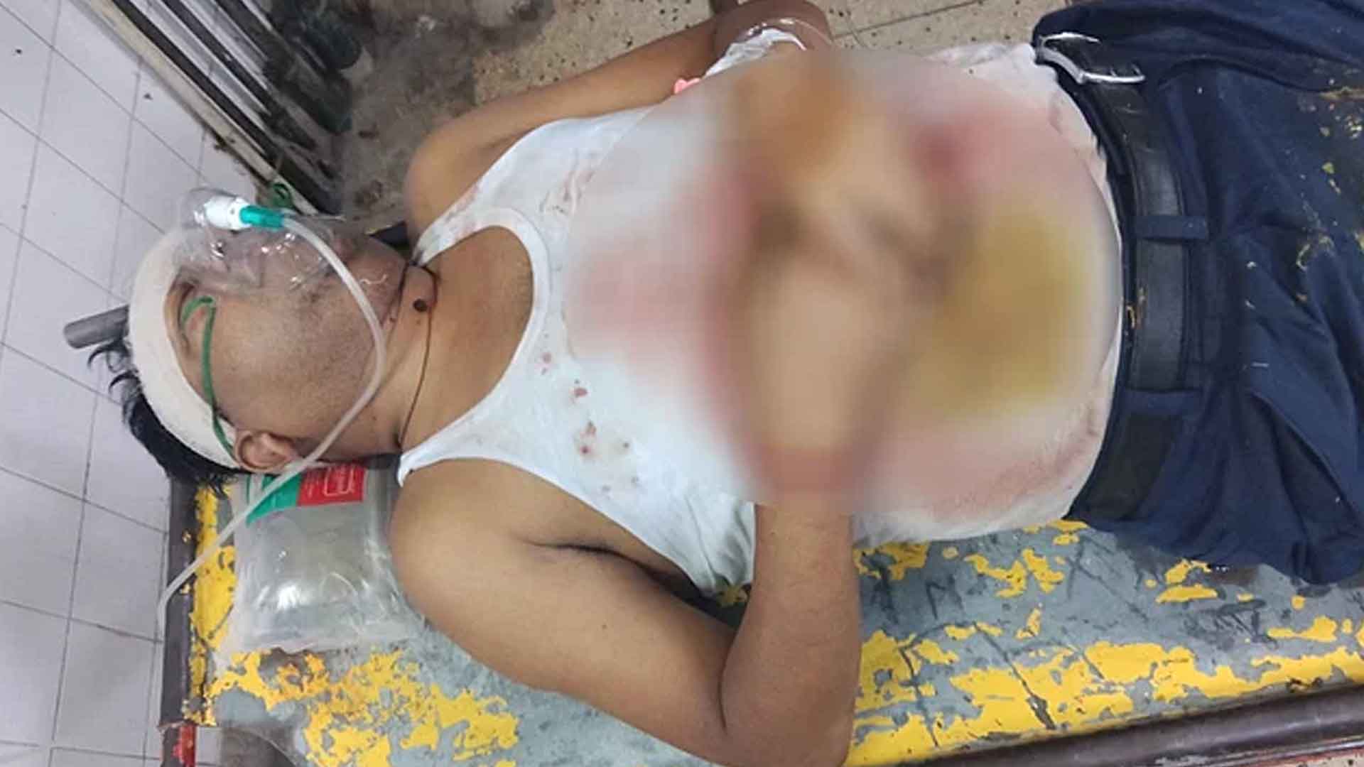 সন্ত্রাসী মামুনকে লক্ষ্য করে ‘প্রতিপক্ষের’ গুলি, মোটরসাইকেল আরোহী গুলিবিদ্ধ