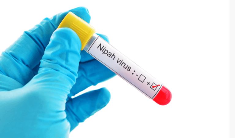 নিপাহ ভাইরাসের লক্ষণ কী, খেজুর গুড় বা রস ফুটিয়ে খেলেও কি এটি ছড়ায়