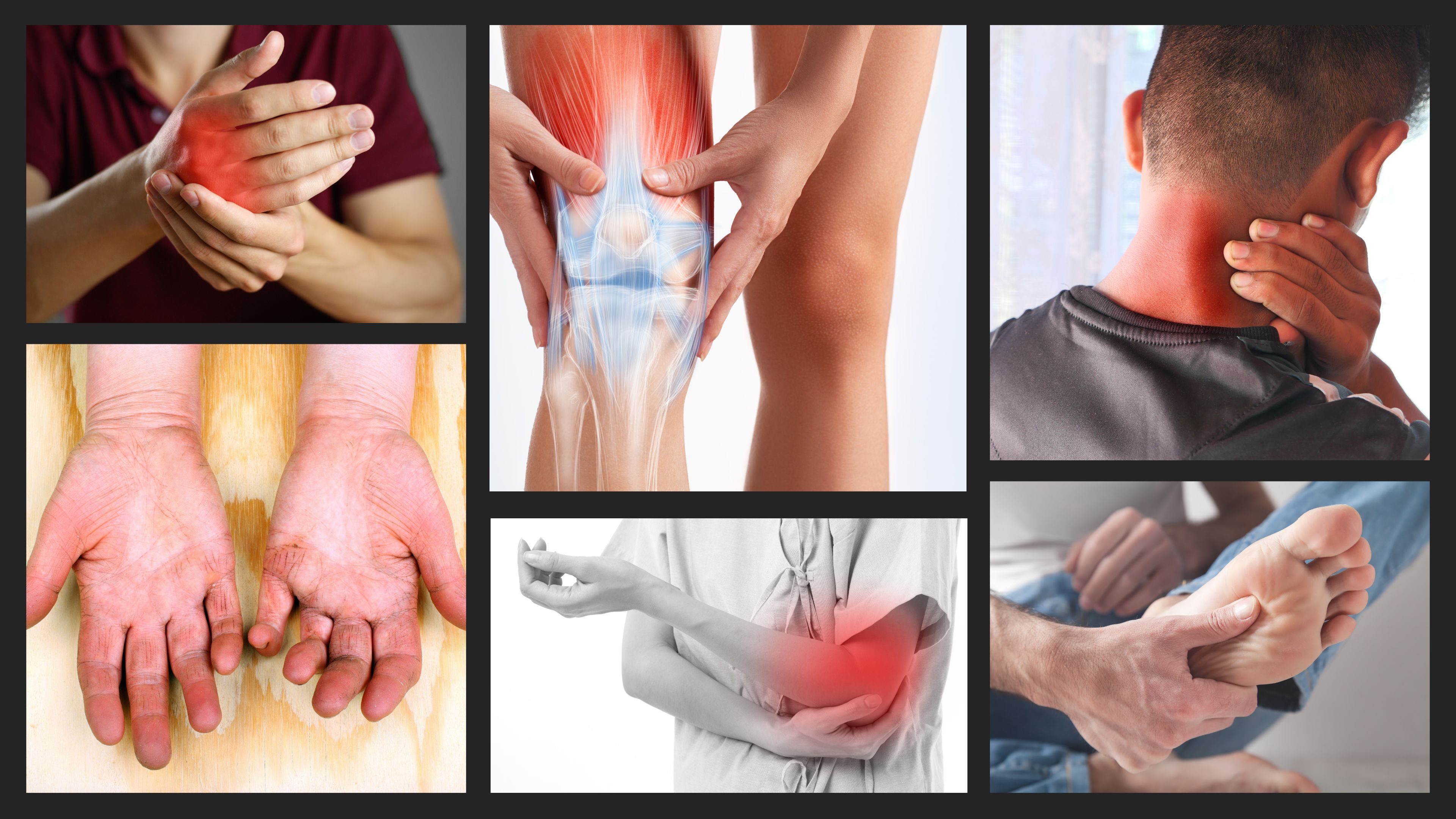 আর্থ্রাইটিস কেন হয়, লক্ষণ ও চিকিৎসা