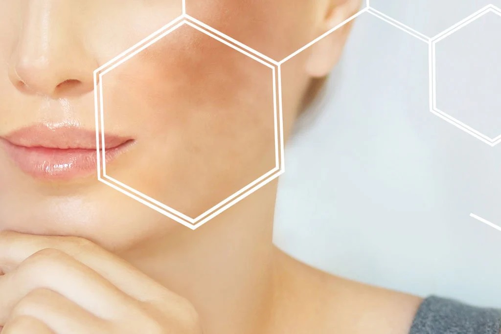 ত্বকে হাইপারপিগমেন্টেশন কেন হয়, প্রতিরোধ ও চিকিৎসা কী