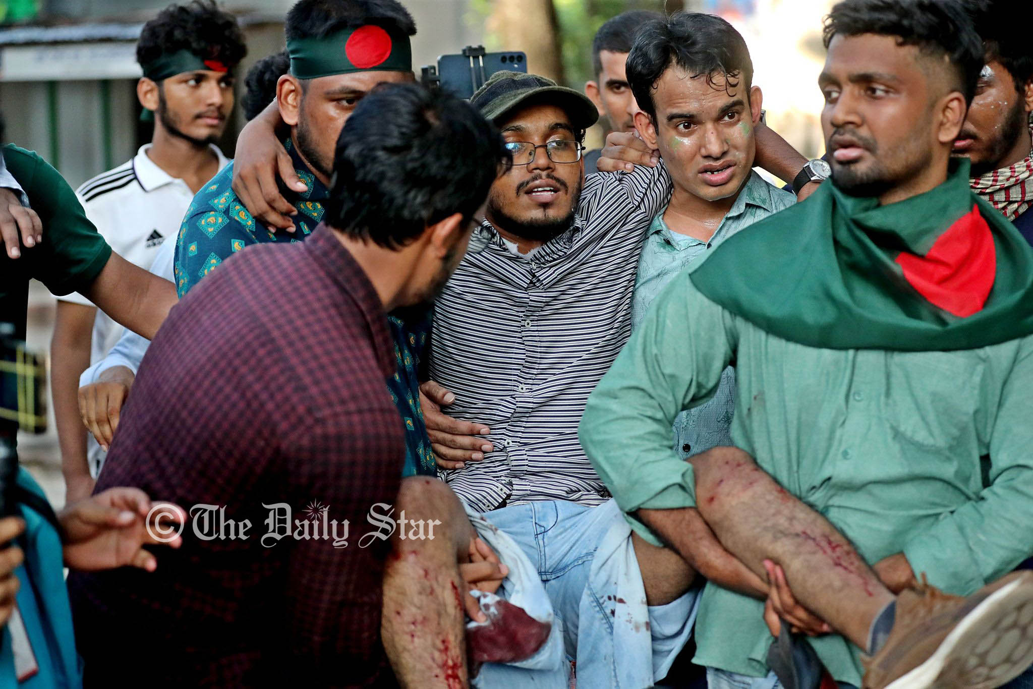 ঢাবিতে ২ শিক্ষার্থী গুলিবিদ্ধ, টিয়ারশেল-সাউন্ড গ্রেনেডে আহত অন্তত ১৫