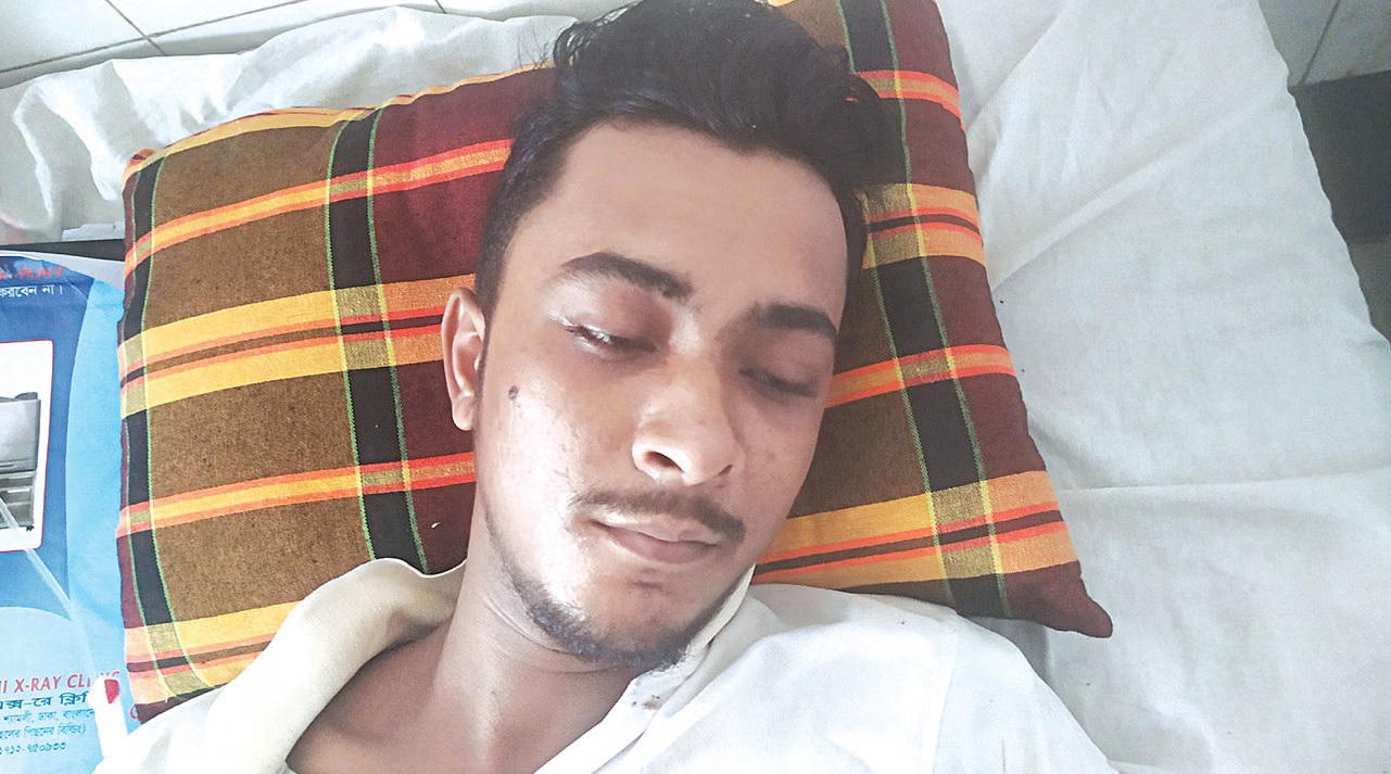 ‘দোকানের শাটার ভেঙে খুব কাছ থেকে পায়ে গুলি করে পুলিশ’