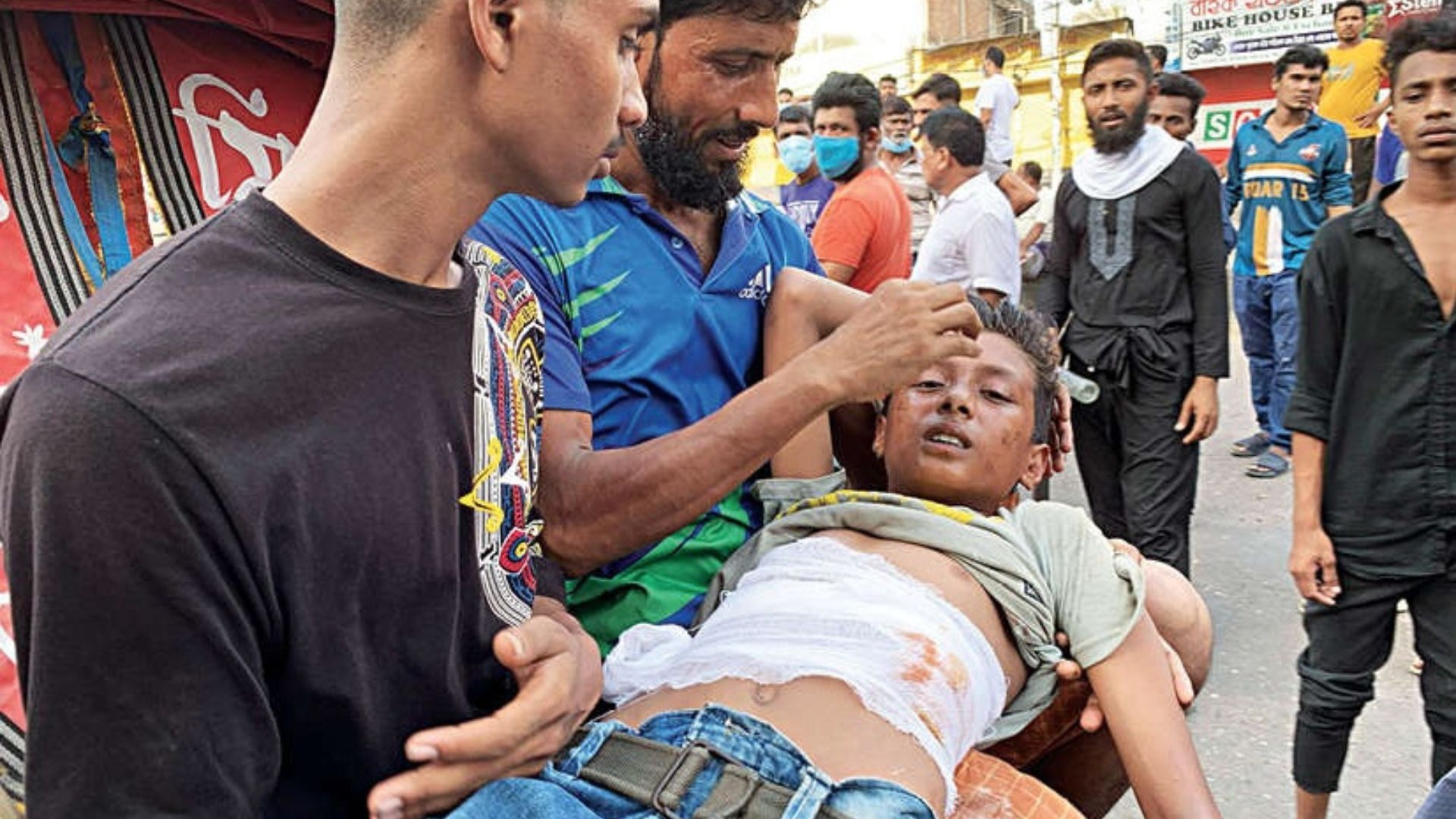 ‘আঘাত আর যন্ত্রণার ছাপ তাদের চোখে-মুখে’