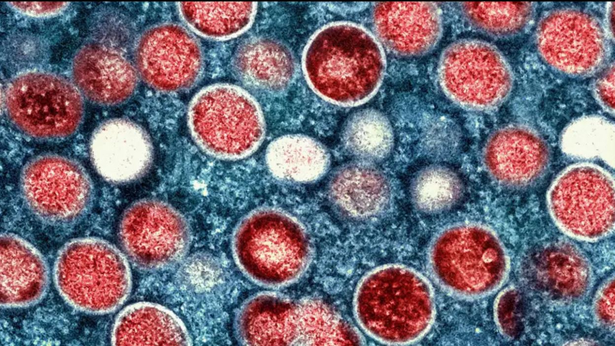 এমপক্স: বাংলাদেশ ও পাকিস্তান সীমান্তে সতর্কতা বাড়াল ভারত 