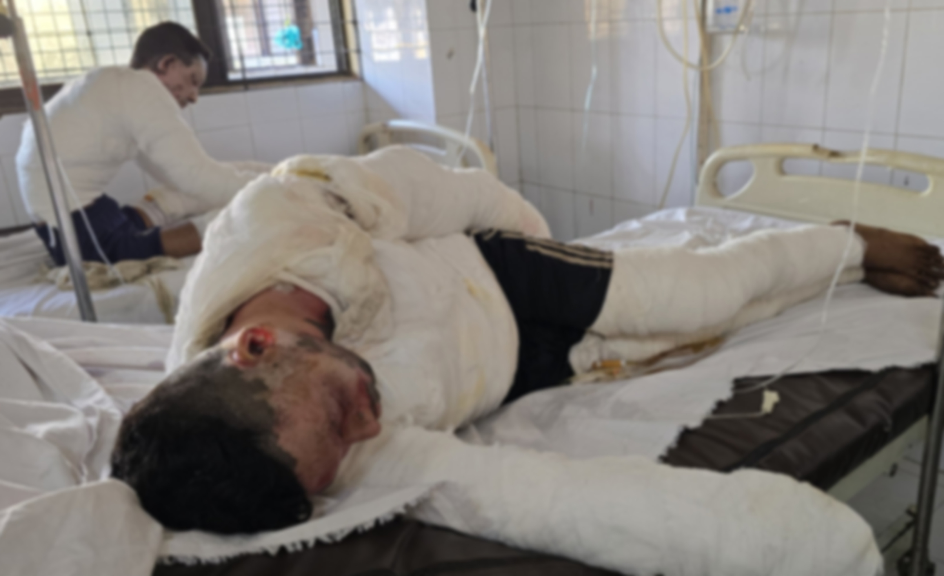 শিপব্রেকিং ইয়ার্ডে বিস্ফোরণে দগ্ধদের কেউই আশঙ্কামুক্ত নন: চিকিৎসক