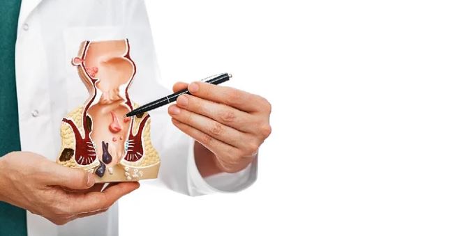 ফিস্টুলা কেন হয়, চিকিৎসা কী