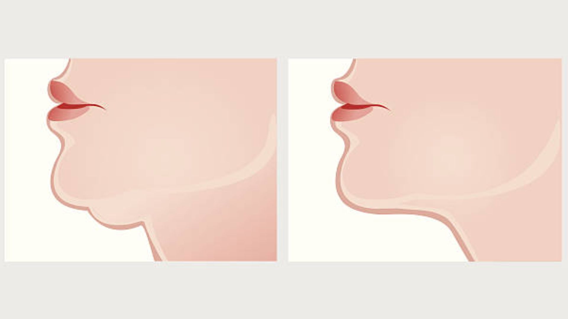 চিবুক ফুলে ব্যথা, টনসিল নাকি অন্যকিছু?