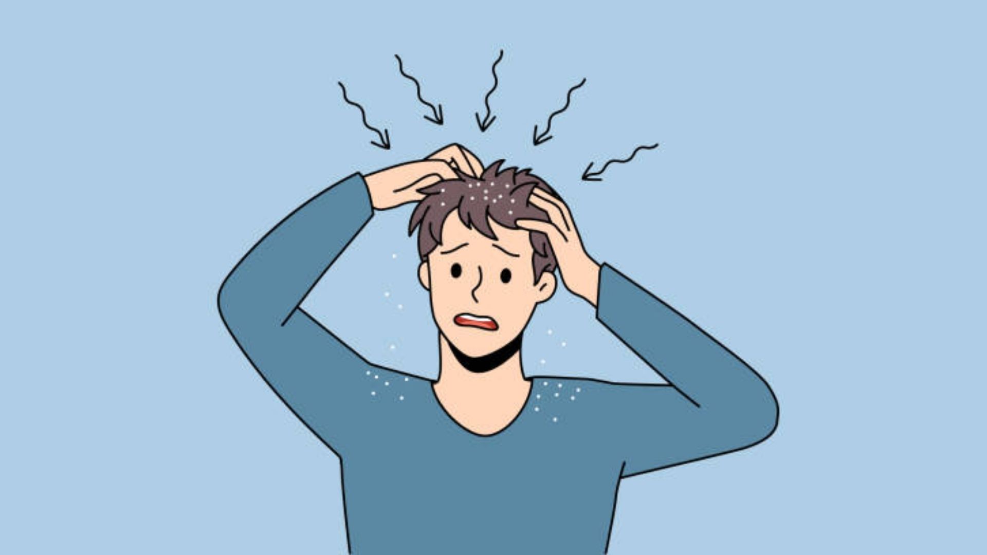 শীতে কি খুশকি বাড়ে