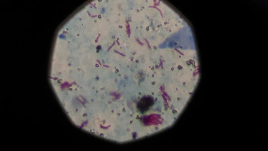 মালয়েশিয়ায় যক্ষ্মার প্রাদুর্ভাব, সতর্কতা জারি। ছবি: রয়টার্স