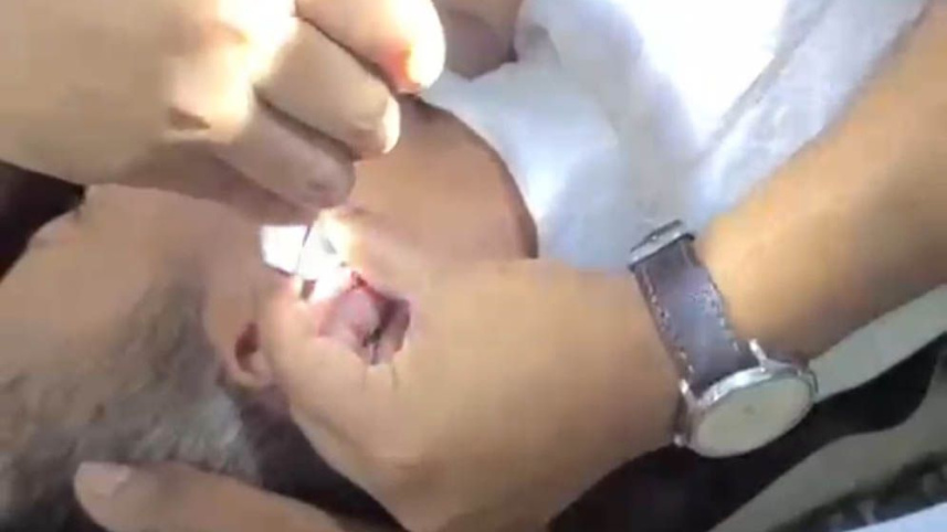 yaba surgery