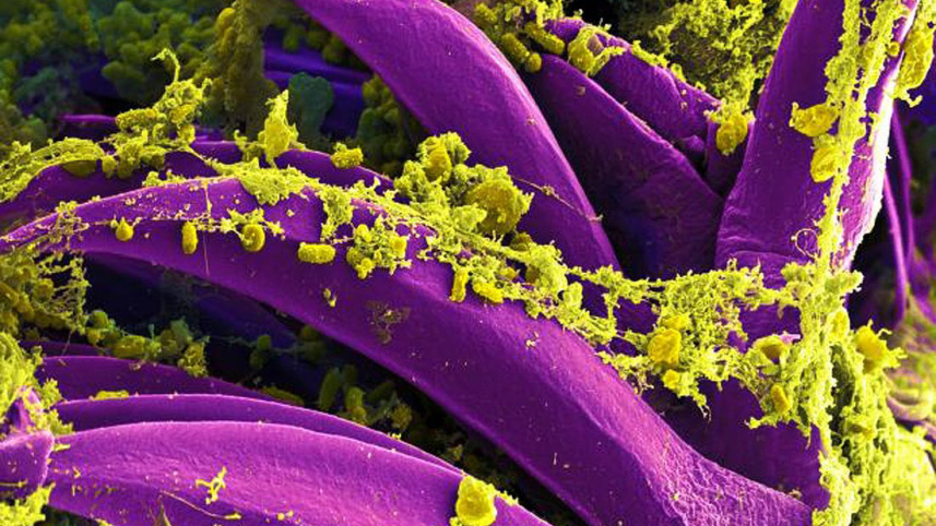 bubonic plague-1.jpg