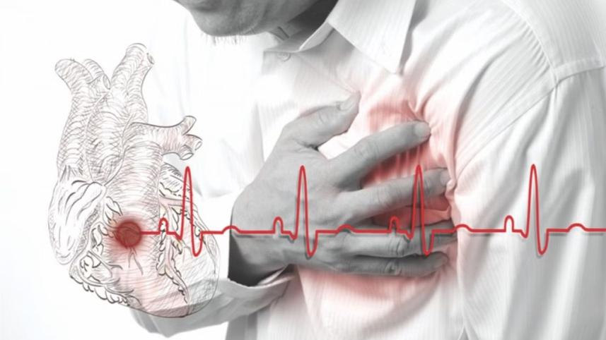 হার্ট অ্যাটাক