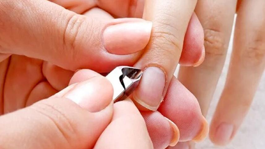 নখের পাশে চামড়া ওঠা