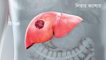 liver-cancer.jpg