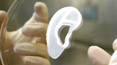 innovation_health-wellbeing_a-3d-printed-ear-made-from-the-patients-own-cells.png