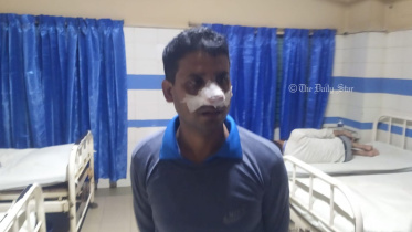 ২ জঙ্গি ছিনতাই: আহত পুলিশ সদস্য চোখে দেখতে পাচ্ছেন